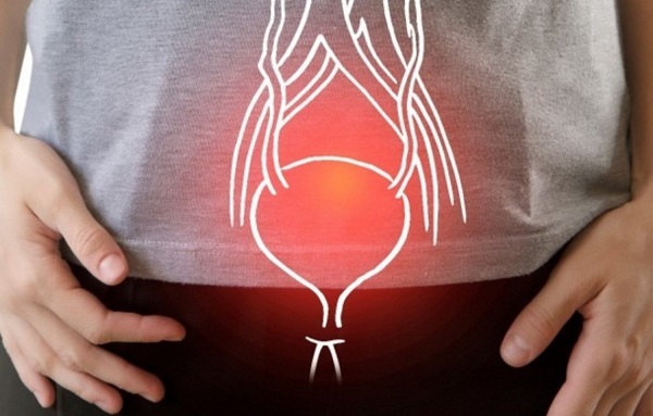 bien-chung-cua-u-xo-phi-dai-tien-liet-tuyen2